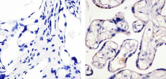 Phospho-eNOS (Ser1179) Antibody in Immunohistochemistry (Paraffin) (IHC (P))