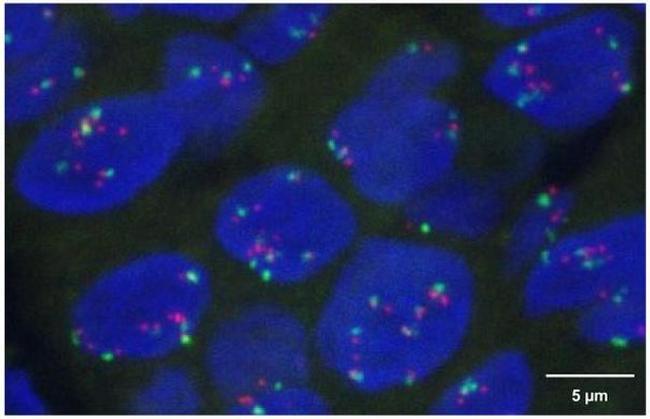 Phospho-EGFR (Tyr1086) Antibody in Immunohistochemistry (IHC)