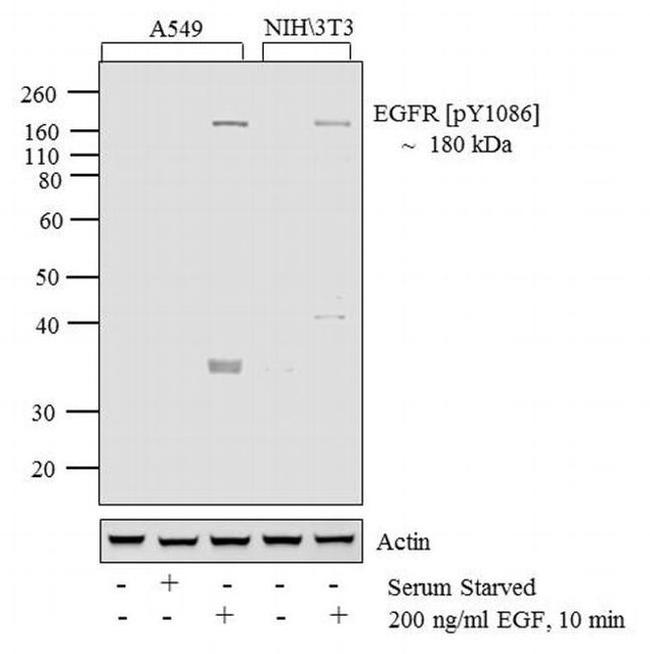 Phospho-EGFR (Tyr1086) Antibody