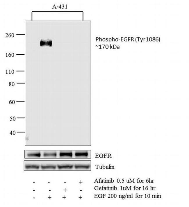 Phospho-EGFR (Tyr1086) Antibody in Western Blot (WB)