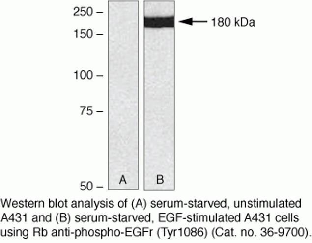 Phospho-EGFR (Tyr1086) Antibody in Western Blot (WB)