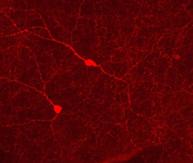 Phospho-Tyrosine Hydroxylase (Ser31) Antibody in Immunocytochemistry (ICC/IF)