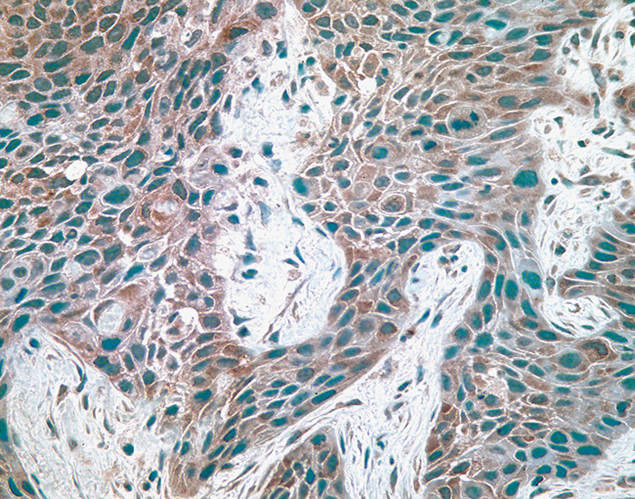 c-Met Antibody in Immunohistochemistry (IHC)