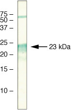 PEBP1 Antibody in Western Blot (WB)