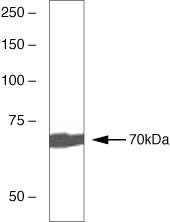 Zap-70 Antibody in Western Blot (WB)