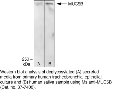 MUC5B Antibody in Western Blot (WB)