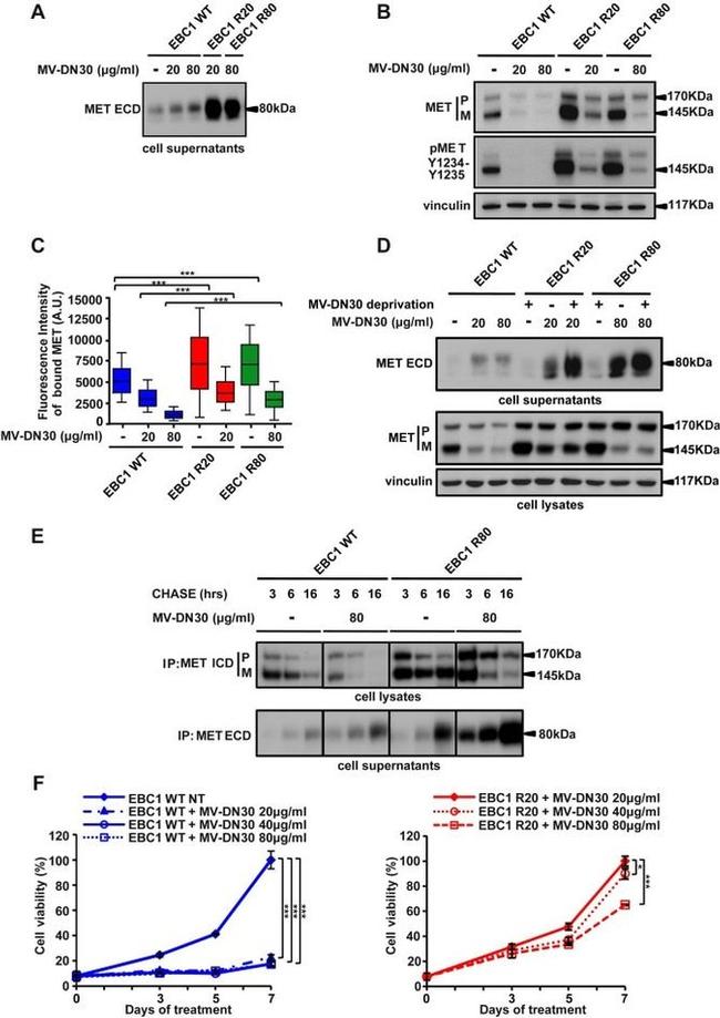 c-Met Antibody in Western Blot (WB)