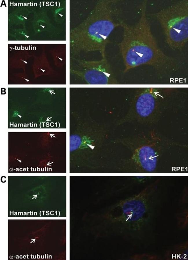 TSC1 Antibody in Immunocytochemistry (ICC/IF)