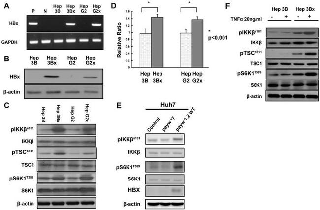 TSC1 Antibody in Western Blot (WB)