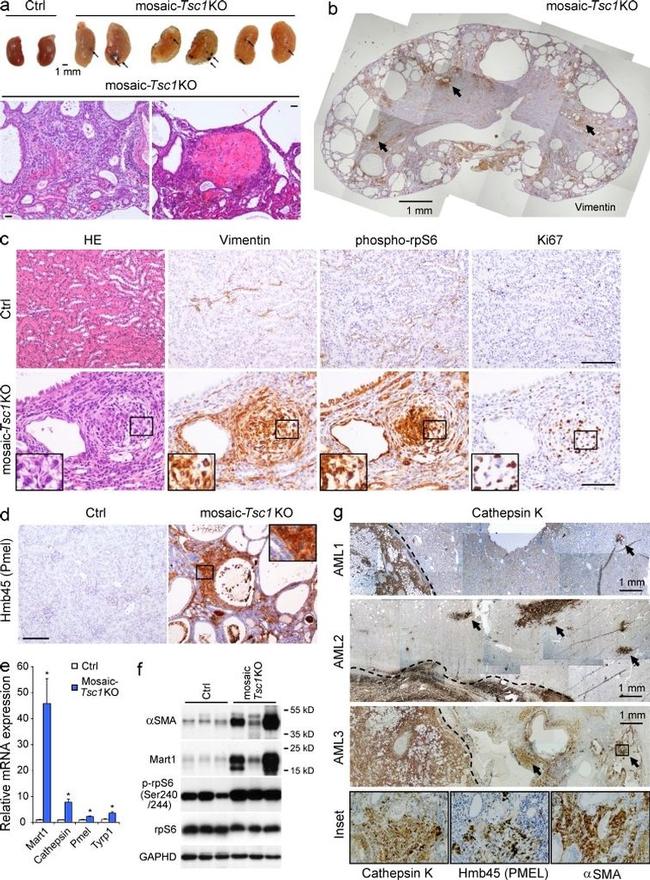 TSC1 Antibody in Immunohistochemistry (IHC)