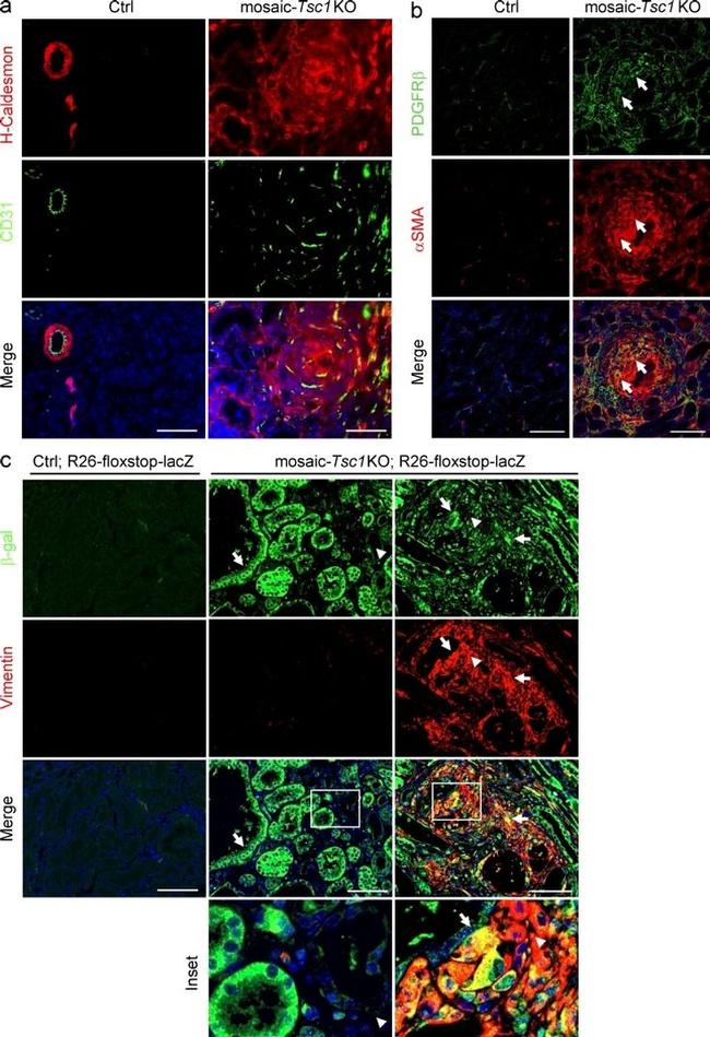 TSC1 Antibody in Immunohistochemistry (IHC)