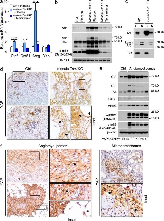 TSC1 Antibody in Immunohistochemistry (IHC)