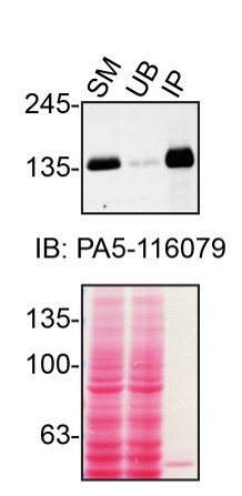 TSC1 Antibody in Immunoprecipitation (IP)