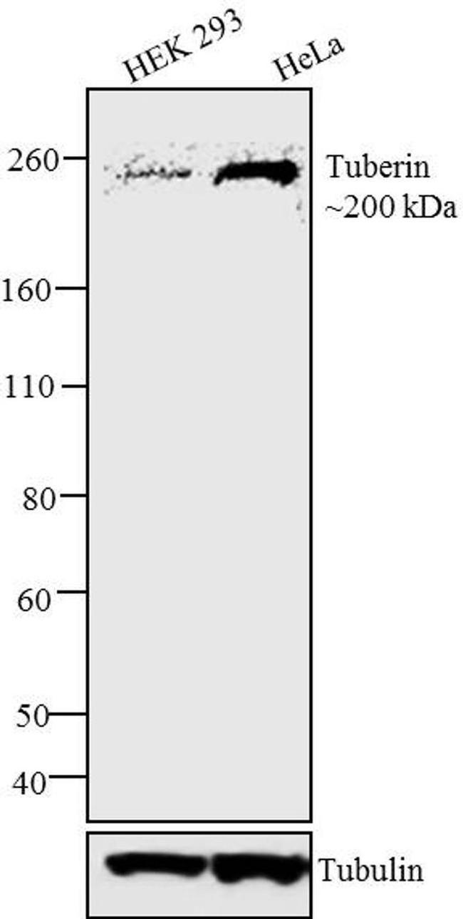 TSC2 Antibody in Western Blot (WB)