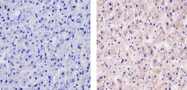 TSC2 Antibody in Immunohistochemistry (Paraffin) (IHC (P))