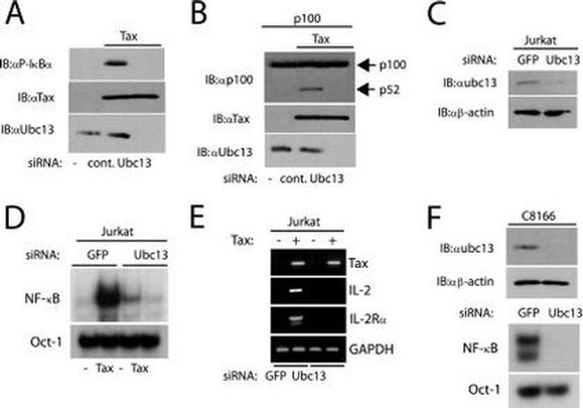 UBC13 Antibody in Western Blot (WB)