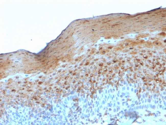 Involucrin (Squamous Cell Terminal Differentiation Marker) Antibody in Immunohistochemistry (Paraffin) (IHC (P))