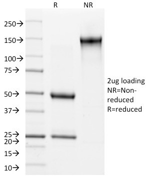 Involucrin (Squamous Cell Terminal Differentiation Marker) Antibody in SDS-PAGE (SDS-PAGE)