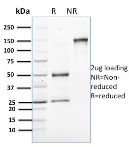 Involucrin (Squamous Cell Terminal Differentiation Marker) Antibody in SDS-PAGE (SDS-PAGE)