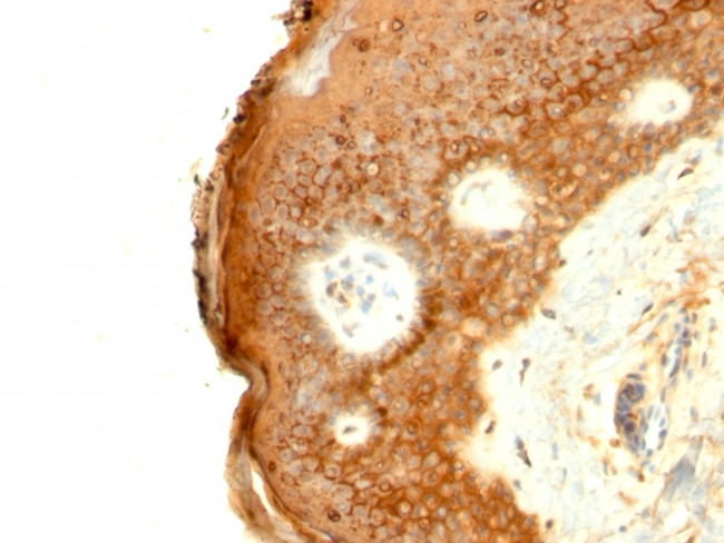 Involucrin (Squamous Cell Terminal Differentiation Marker) Antibody in Immunohistochemistry (Paraffin) (IHC (P))