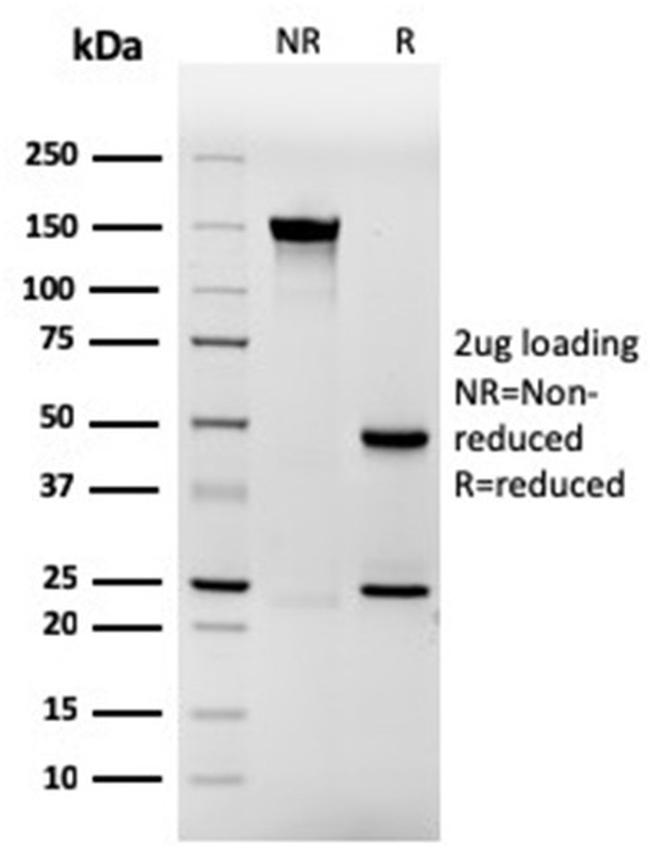 Involucrin Antibody in SDS-PAGE (SDS-PAGE)