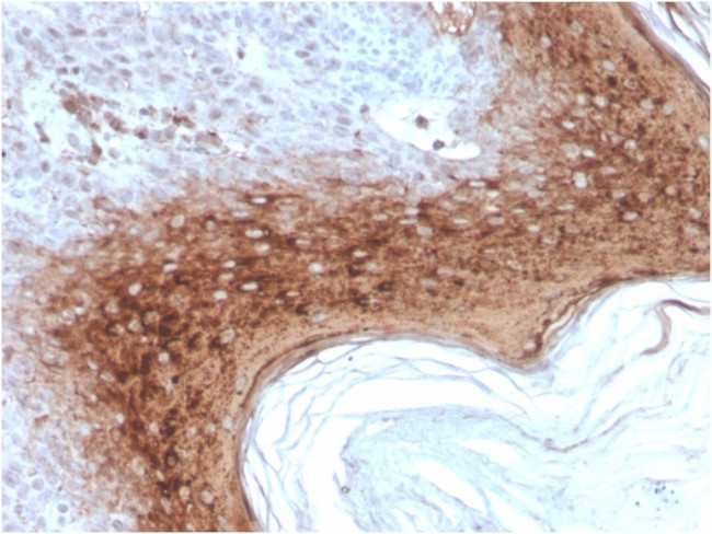 Involucrin Antibody in Immunohistochemistry (Paraffin) (IHC (P))