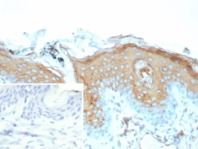 Involucrin (Squamous Cell Terminal Differentiation Marker) Antibody in Immunohistochemistry (Paraffin) (IHC (P))