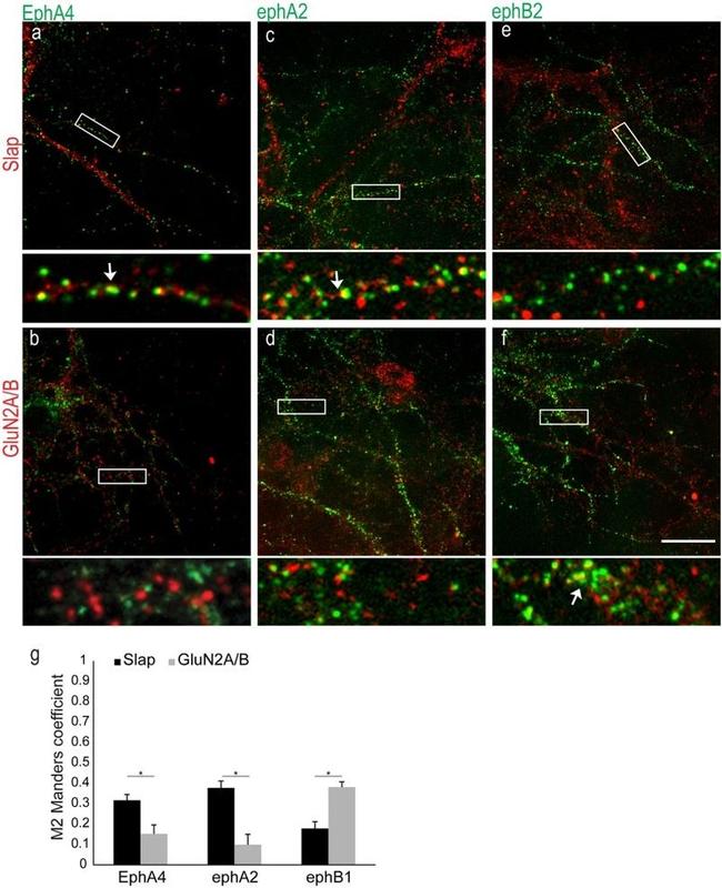 EphA4 Antibody in Immunocytochemistry (ICC/IF)