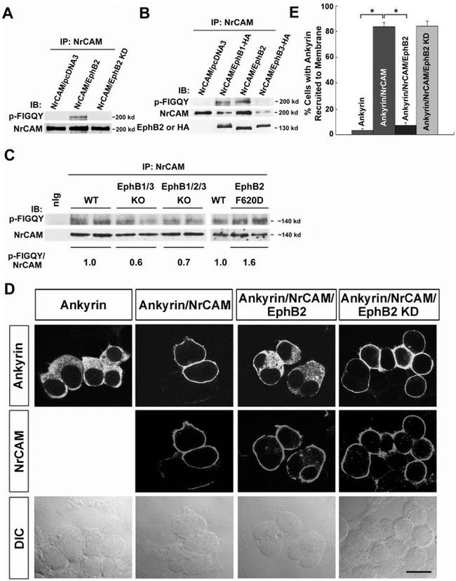 EphB2 Antibody in Western Blot, Immunocytochemistry, Immunoprecipitation (WB, ICC/IF, IP)