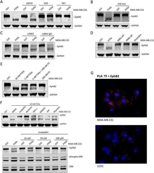 EphB2 Antibody in Western Blot (WB)