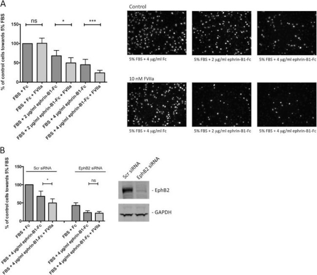 EphB2 Antibody in Western Blot (WB)