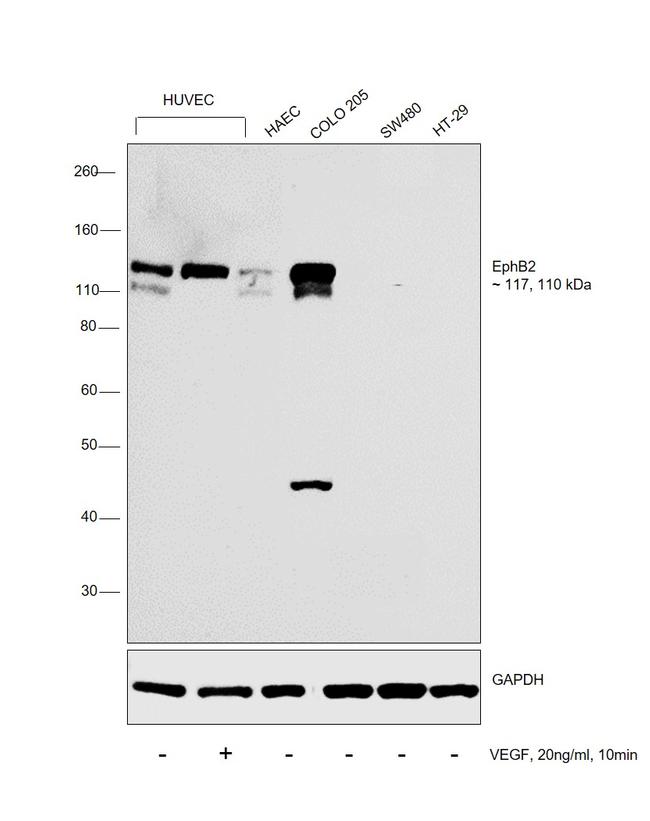 EphB2 Antibody in Western Blot (WB)