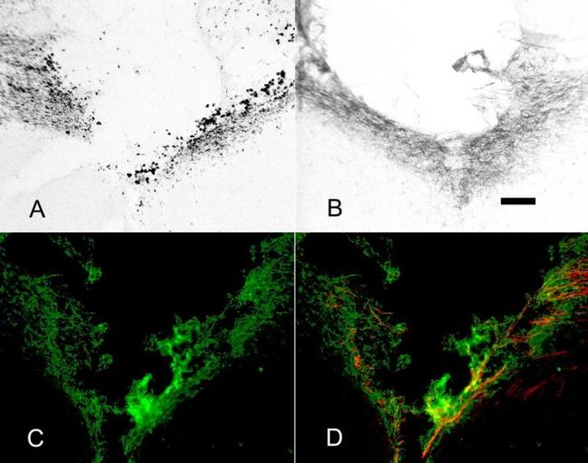 NG2 Antibody in Immunocytochemistry (ICC/IF)