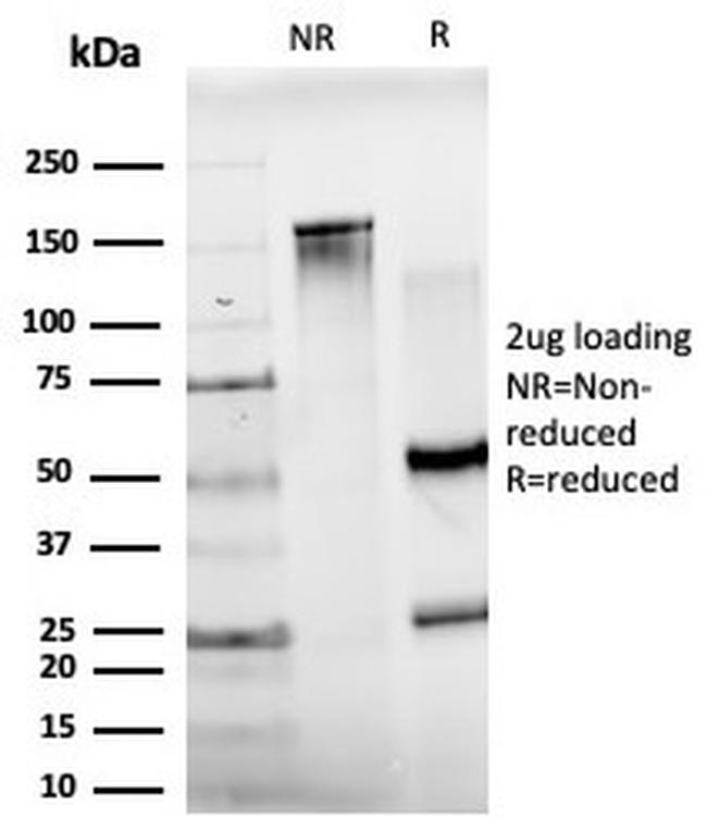 JunB/Transcription Factor JunB Antibody in SDS-PAGE (SDS-PAGE)