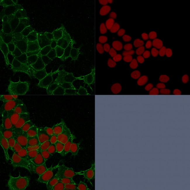 Catenin, gamma (Cardiomyocyte Marker) Antibody in Immunocytochemistry (ICC/IF)