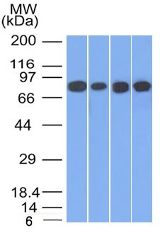 Catenin, gamma (Cardiomyocyte Marker) Antibody in Western Blot (WB)