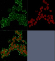 Catenin, gamma (Cardiomyocyte Marker) Antibody in Immunocytochemistry (ICC/IF)