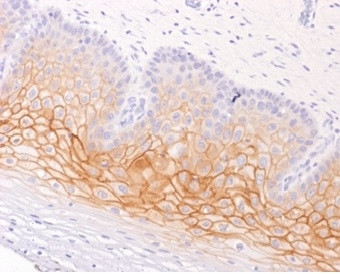 Catenin, gamma (Cardiomyocyte Marker) Antibody in Immunohistochemistry (Paraffin) (IHC (P))