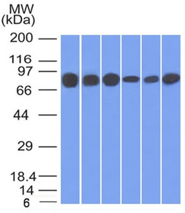 Catenin, gamma (Cardiomyocyte Marker) Antibody in Western Blot (WB)