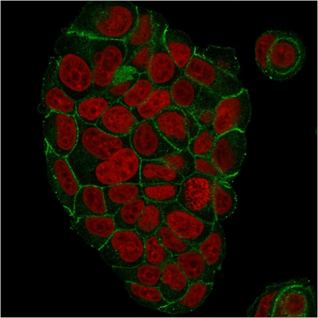 Catenin, gamma Antibody in Immunocytochemistry (ICC/IF)