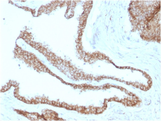 Catenin, gamma Antibody in Immunohistochemistry (Paraffin) (IHC (P))