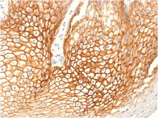 Catenin, gamma Antibody in Immunohistochemistry (Paraffin) (IHC (P))