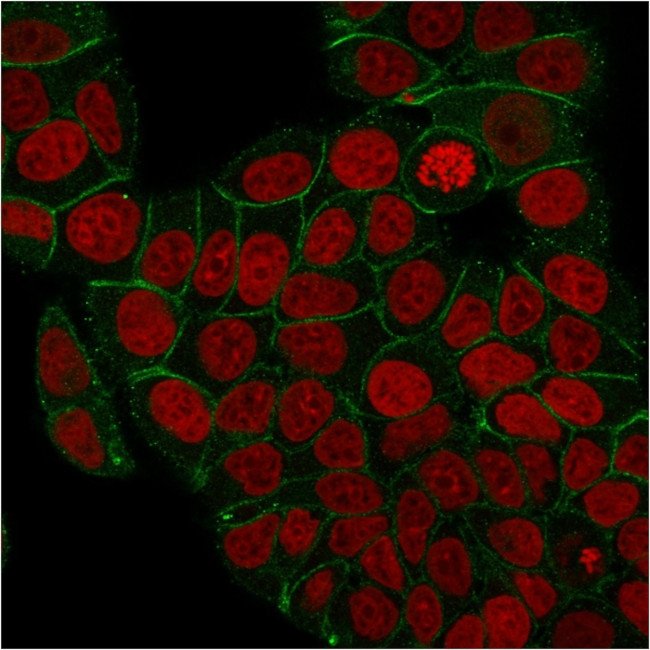 Catenin, gamma (Cardiomyocyte Marker) Antibody in Immunocytochemistry (ICC/IF)