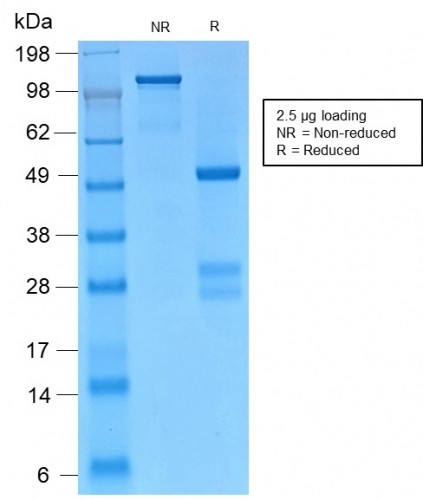 Catenin, gamma (Cardiomyocyte Marker) Antibody in SDS-PAGE (SDS-PAGE)