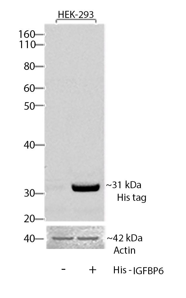 6x-His Tag Antibody in Western Blot (WB)