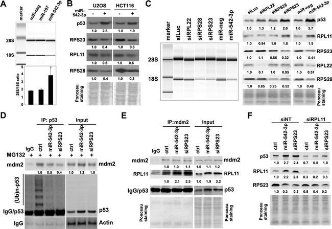 RPL11 Antibody in Western Blot (WB)