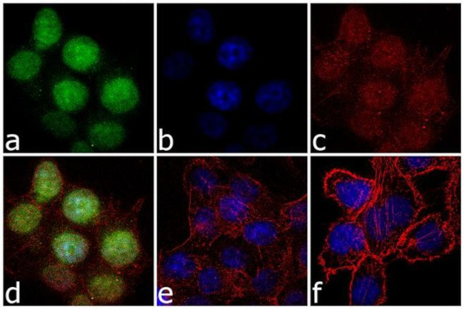 RPL11 Antibody in Immunocytochemistry (ICC/IF)