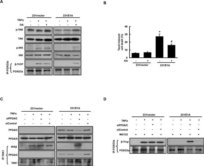 BTRC Antibody in Western Blot (WB)