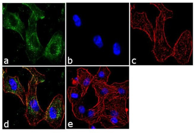 BTRC Antibody in Immunocytochemistry (ICC/IF)