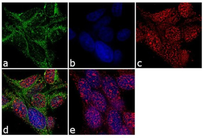 PSMA Antibody in Immunocytochemistry (ICC/IF)